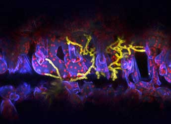 Confocal image of GFP-expressing Ramularia cygni