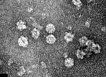 Image of Bovine papilloma virus-like particles produced in plants