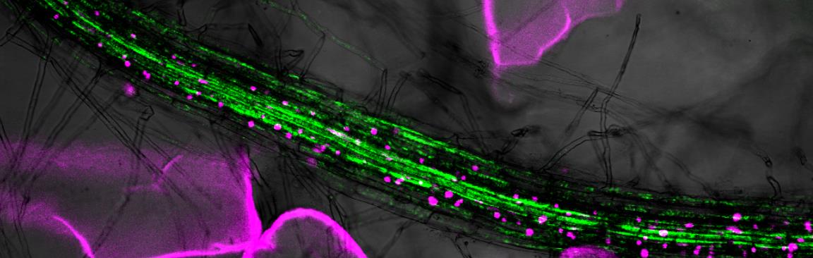 Image obtained using new transparent soil technology (c) James Hutton Institute