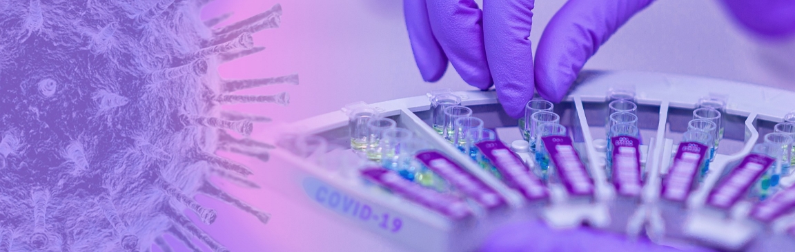 Scottish institutes help to tackle COVID19 (Image Fernando Zhiminaicela/Pixabay)