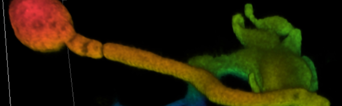 Initial penetration of a leaf by P. infestans 