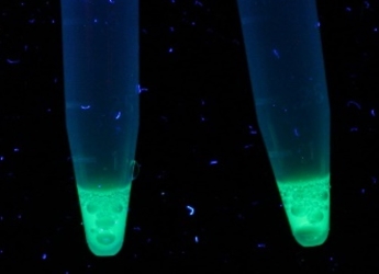Purified fluorescently labelled diagnostic proteins under UV light