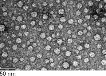 In planta produced BPV VLPs