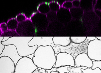 E.coli bacteria growing in a root seen using confocal and EM imaging