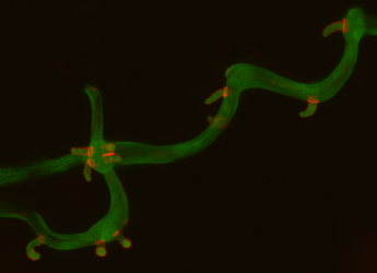 Image showing mRFP tagged PiHMP1 protein