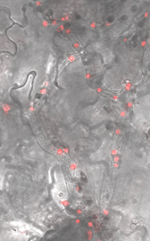 Image showing avr2_mRFP in P infestans