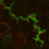 Image of Avr3a_mRFP fusion in haustoria of P. infestans