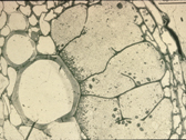 Image of PCN syncytium