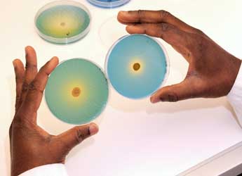 Photograph of gell in petri dishes being compared