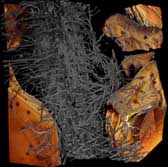 Figure 2: Lettuce root