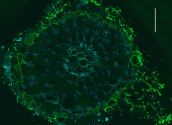 Image showing Colonisation of spinach roots (magenta) by E. coli O157:H7 (green)