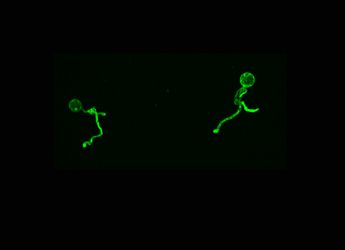 Germinating cysts of P. infestans stained with a lipid A stain 