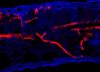Image showing P. infestans expressing tdTomato on N. benthamiana