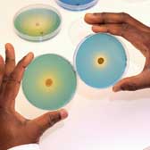  Selection of bacteria for P solubilisation observed by clearing of media