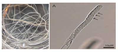 Figure 1: A. rhizogenes transformed potato roots. A = S. subterranea plasmodia inside a root hair.