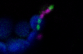 E. coli bacteria within a spinach leaf