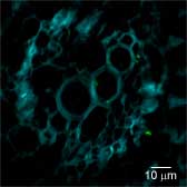 (B) Close-up of systemic tissue of the same spinach root showing bacteria within xylem vessels.