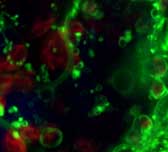 Image of FM1-43 labelled vesicles and membrane compartments in a PMTV-infected Nicotiana benthamiana leaf epidermal cell