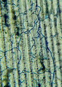 Could a Hidden Fungus Be the Future of UK Farming?