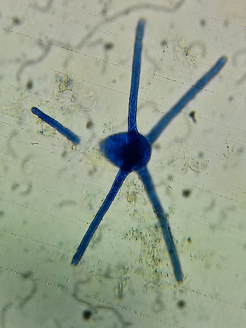 Aquatic or Ingoldian fungi.  very unique in shape
